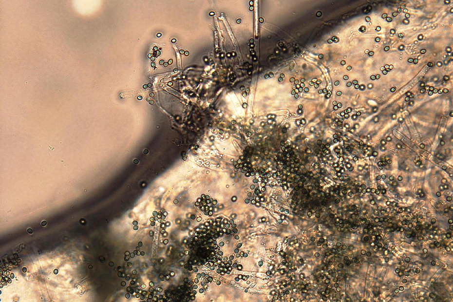esporas-trichoderma-fungicida-para-botrytis-en-tomate